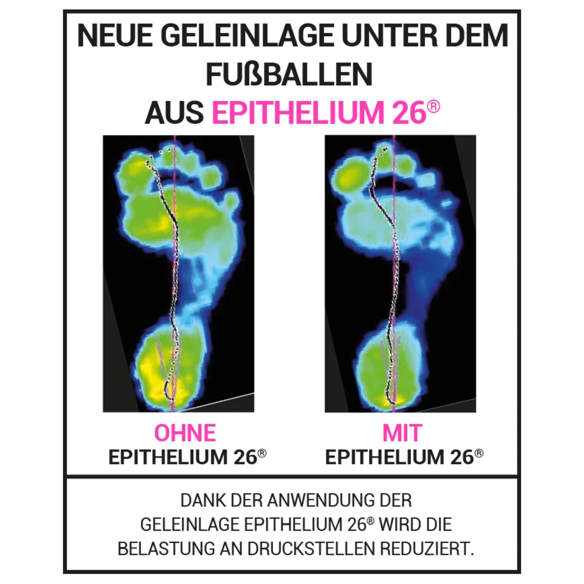EPITACT® Fusssohlenkissen COMFORTACT™ PLUS