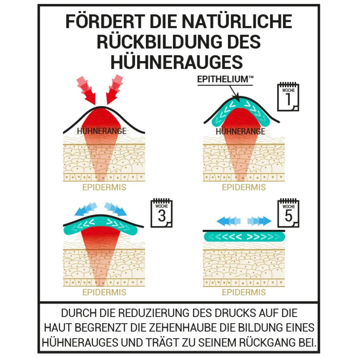 Gel Zehenschutz bei Hühneraugen