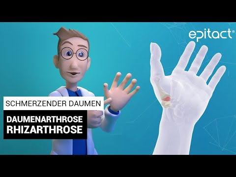 Erklärvideo zur Daumenarthrose