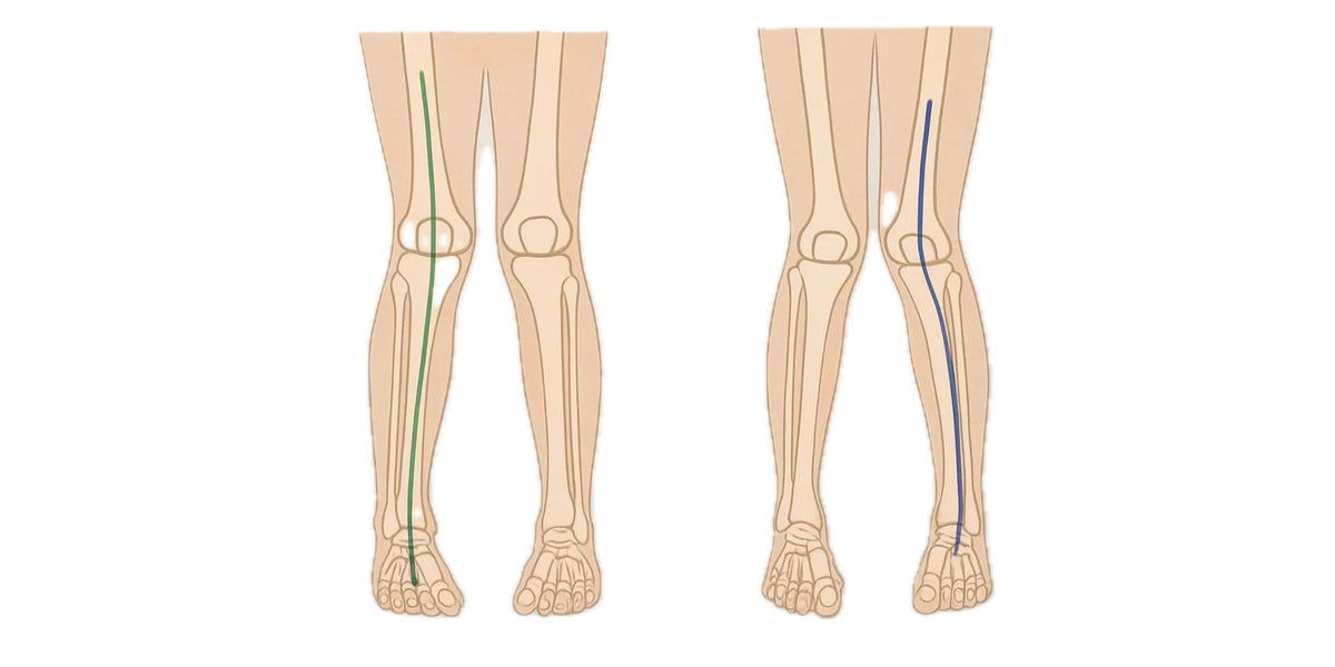 Artikel zur Valgusgonarthrose