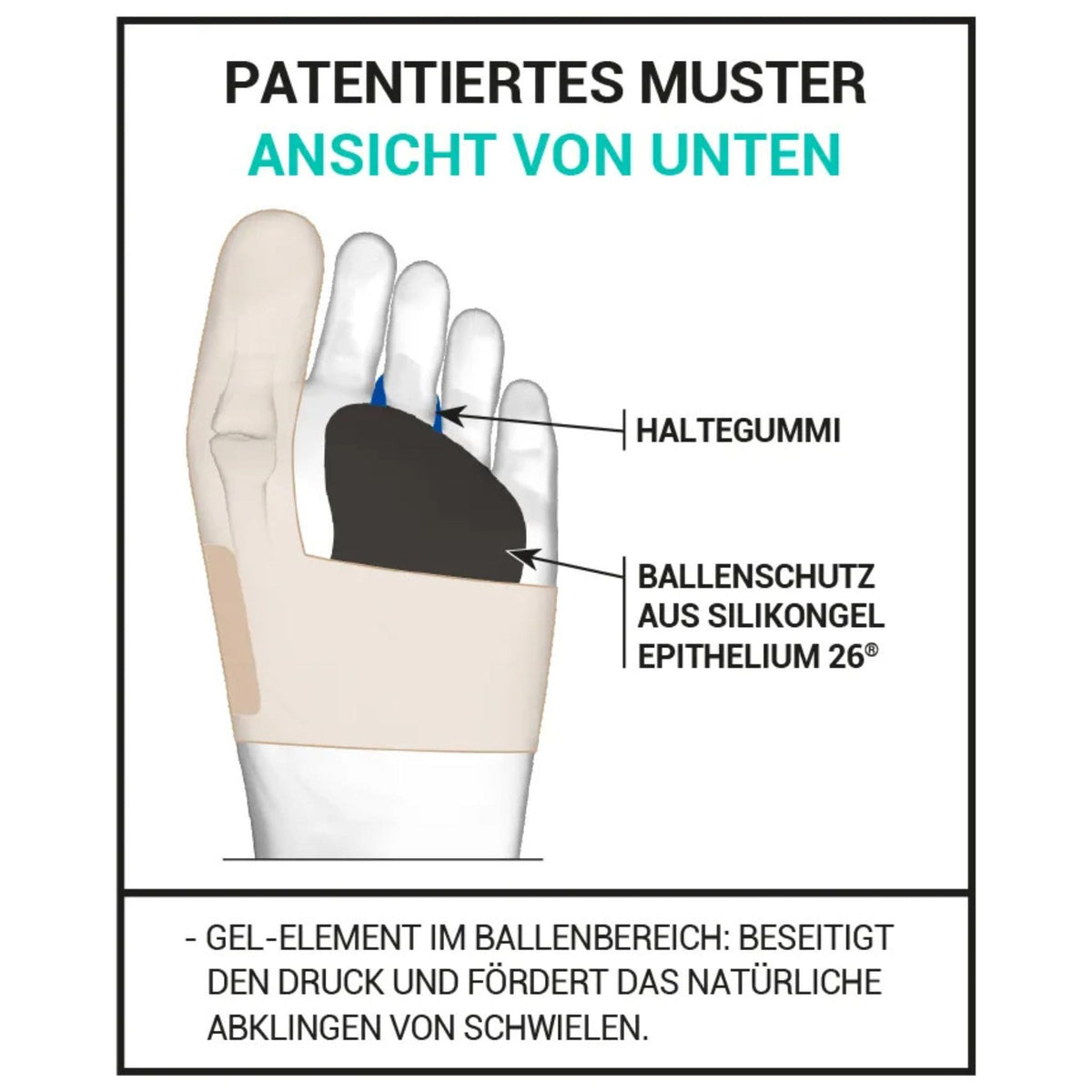 Aufbau der Korrekturbandage Erklärung