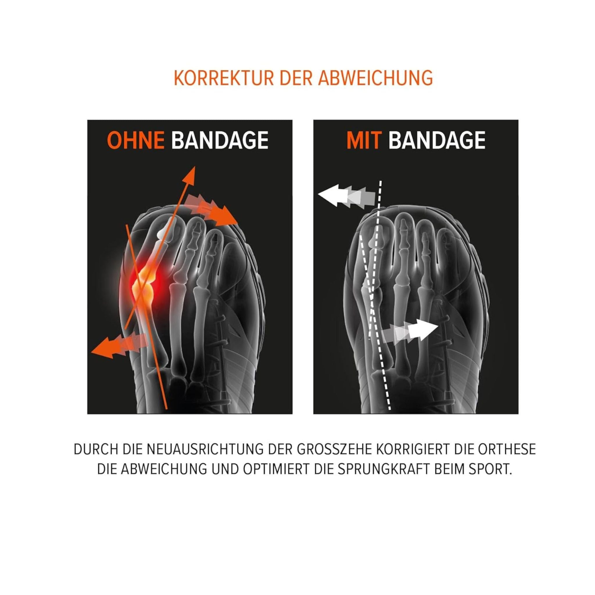 Ballenzeh Polster Bandage Sport