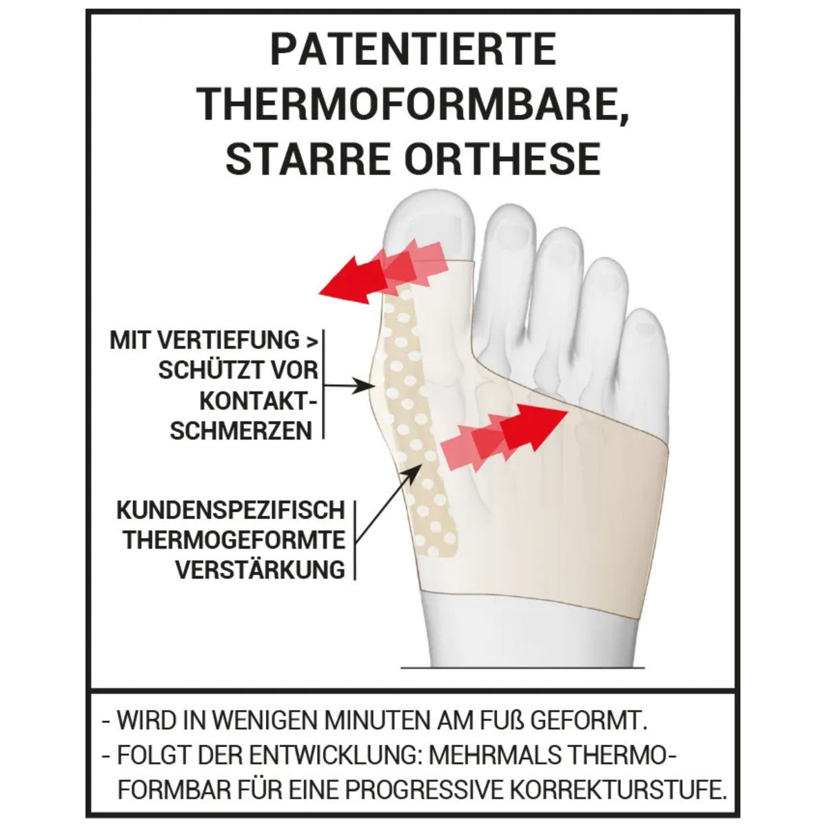 Erklärung der Wirkweise bei Hallux Valgus