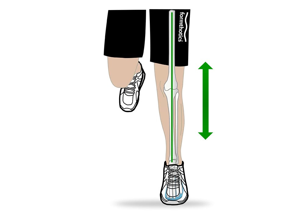 Geländelauf Joggen Fussschmerzen