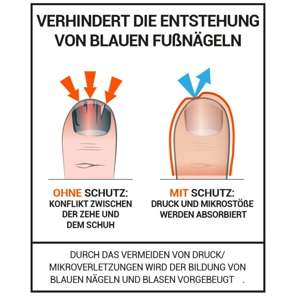 Zehenpolsterung gegen blaue Nägel
