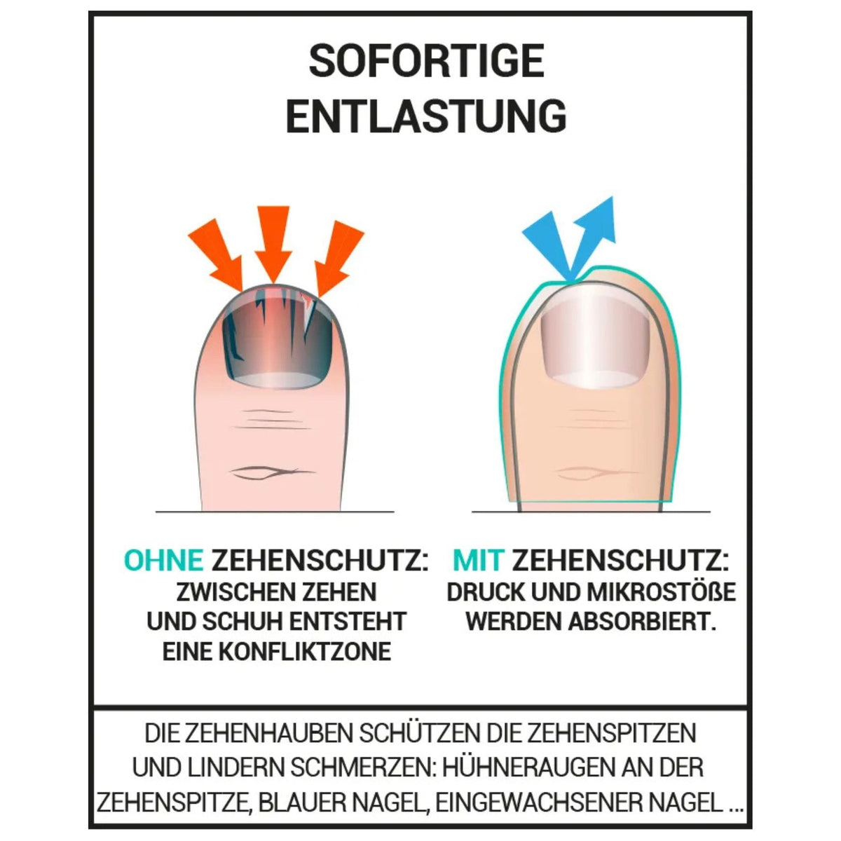 Zehenschutz gegen blaue Zehennägel