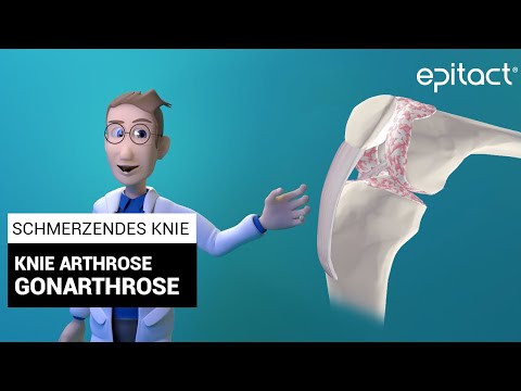 Erklärung zur Arthrose im Knie
